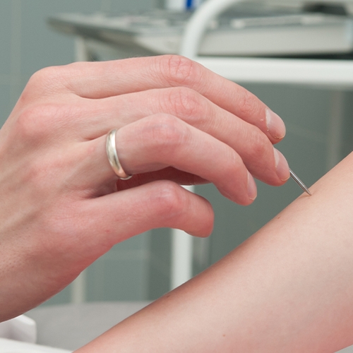 physiotherapy-center-neurological-conditions-msk-health-and-performance-clinic-vancouver-burnaby-metrotown-bc